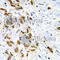 Cathepsin E antibody, A2678, ABclonal Technology, Immunohistochemistry paraffin image 