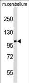 Protein Arginine Methyltransferase 9 antibody, PA5-48942, Invitrogen Antibodies, Western Blot image 