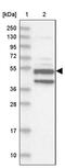 Xylulokinase antibody, PA5-58144, Invitrogen Antibodies, Western Blot image 