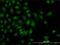 SMAD Family Member 1 antibody, H00004086-M02, Novus Biologicals, Immunocytochemistry image 