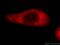 LOR antibody, 55439-1-AP, Proteintech Group, Immunofluorescence image 