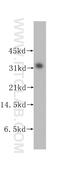 STOM antibody, 12046-1-AP, Proteintech Group, Western Blot image 