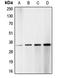 Cyclin Dependent Kinase 1 antibody, LS-C351967, Lifespan Biosciences, Western Blot image 
