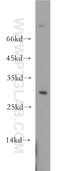 Uroplakin 2 antibody, 21149-1-AP, Proteintech Group, Western Blot image 