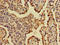 Alpha-2-Macroglobulin Like 1 antibody, CSB-PA001005LA01HU, Cusabio, Immunohistochemistry frozen image 