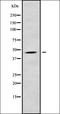 Carbohydrate Sulfotransferase 14 antibody, orb338127, Biorbyt, Western Blot image 