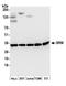 Spermidine synthase antibody, A305-504A, Bethyl Labs, Western Blot image 