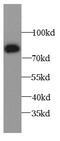 Arachidonate 15-Lipoxygenase Type B antibody, FNab00005, FineTest, Western Blot image 
