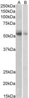 Solute Carrier Family 18 Member A2 antibody, GTX89638, GeneTex, Western Blot image 