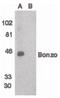 C-X-C Motif Chemokine Receptor 6 antibody, PA5-19936, Invitrogen Antibodies, Western Blot image 