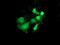 Pyrroline-5-Carboxylate Reductase 3 antibody, MA5-25335, Invitrogen Antibodies, Immunocytochemistry image 