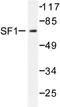 Nuclear Receptor Subfamily 5 Group A Member 1 antibody, AP06579PU-N, Origene, Western Blot image 