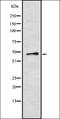 Casein Kinase 1 Gamma 2 antibody, orb378251, Biorbyt, Western Blot image 