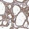 Erythrocyte Membrane Protein Band 4.1 Like 4A antibody, HPA036580, Atlas Antibodies, Immunohistochemistry paraffin image 