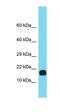 Translocase Of Inner Mitochondrial Membrane 29 antibody, orb326845, Biorbyt, Western Blot image 