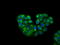 Potassium Channel Tetramerization Domain Containing 5 antibody, GTX84281, GeneTex, Immunocytochemistry image 