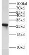 Exosome Component 4 antibody, FNab02904, FineTest, Western Blot image 