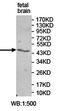 Zinc Finger And SCAN Domain Containing 9 antibody, orb78362, Biorbyt, Western Blot image 