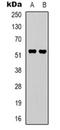 Endothelin B receptor-like protein 2 antibody, orb319084, Biorbyt, Western Blot image 