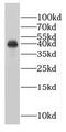 LRAT Domain Containing 2 antibody, FNab02997, FineTest, Western Blot image 
