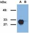 HLA class II histocompatibility antigen, DRB1-15 beta chain antibody, GTX78393, GeneTex, Western Blot image 