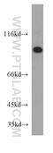 SUZ12 Polycomb Repressive Complex 2 Subunit antibody, 20366-1-AP, Proteintech Group, Western Blot image 