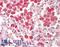 Cathepsin Z antibody, LS-B9745, Lifespan Biosciences, Immunohistochemistry frozen image 