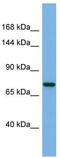 Progesterone Receptor antibody, TA329187, Origene, Western Blot image 
