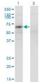 MAGE Family Member B6 antibody, H00158809-M02, Novus Biologicals, Western Blot image 