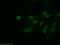 Actin-related protein 5 antibody, 21505-1-AP, Proteintech Group, Immunofluorescence image 