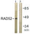 DNA repair protein RAD52 homolog antibody, OAAF01156, Aviva Systems Biology, Western Blot image 