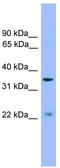 Probable palmitoyltransferase ZDHHC21 antibody, TA333424, Origene, Western Blot image 