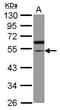 Cell Division Cycle Associated 7 Like antibody, PA5-31761, Invitrogen Antibodies, Western Blot image 