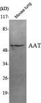 Alpha-1-antitrypsin antibody, STJ98457, St John