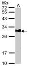 BCL10 Immune Signaling Adaptor antibody, GTX109159, GeneTex, Western Blot image 