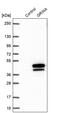 Glutamate Ionotropic Receptor NMDA Type Subunit Associated Protein 1 antibody, PA5-57897, Invitrogen Antibodies, Western Blot image 