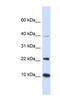 Ubiquitin-conjugating enzyme E2 D2 antibody, NBP1-55275, Novus Biologicals, Western Blot image 
