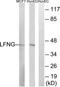 LFNG O-Fucosylpeptide 3-Beta-N-Acetylglucosaminyltransferase antibody, TA314150, Origene, Western Blot image 