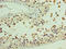 Aminoadipate-Semialdehyde Dehydrogenase-Phosphopantetheinyl Transferase antibody, LS-C372037, Lifespan Biosciences, Immunohistochemistry paraffin image 