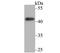 TNF Receptor Superfamily Member 11b antibody, NBP2-76904, Novus Biologicals, Western Blot image 