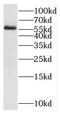 Peroxisomal N(1)-acetyl-spermine/spermidine oxidase antibody, FNab06138, FineTest, Western Blot image 