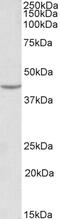Calbindin 1 antibody, 43-170, ProSci, Immunohistochemistry paraffin image 