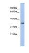 Peroxisomal Biogenesis Factor 7 antibody, NBP1-57578, Novus Biologicals, Western Blot image 