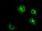 Lysyl Oxidase antibody, MA5-25033, Invitrogen Antibodies, Immunocytochemistry image 