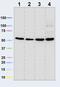 ATP Synthase F1 Subunit Beta antibody, ab14730, Abcam, Western Blot image 