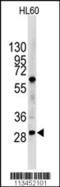 Lin-28 Homolog B antibody, TA324574, Origene, Western Blot image 