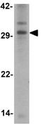 Kallikrein Related Peptidase 4 antibody, GTX31887, GeneTex, Western Blot image 