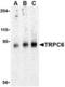 Short transient receptor potential channel 6 antibody, TA306348, Origene, Western Blot image 