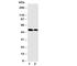 LKLF antibody, R31019, NSJ Bioreagents, Western Blot image 