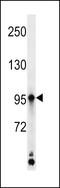 Kazrin antibody, LS-C159965, Lifespan Biosciences, Western Blot image 